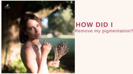 remove pigmentation
