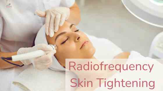 Radiofrequency Skin Tightening